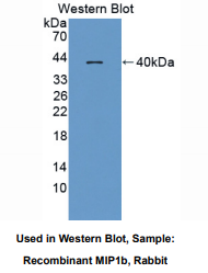 兔巨噬细胞炎性蛋白1β(MIP1b)多克隆抗体