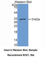 大鼠内皮素转化酶1(ECE1)多克隆抗体