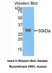 人牛痘相关激酶1(VRK1)多克隆抗体