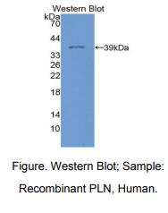 人受磷蛋白(PLN)多克隆抗体