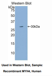 人肌球蛋白重链4(MYH4)多克隆抗体
