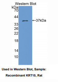 大鼠角蛋白15(CK15)多克隆抗体